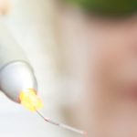 Laser-Parodontitistherapie